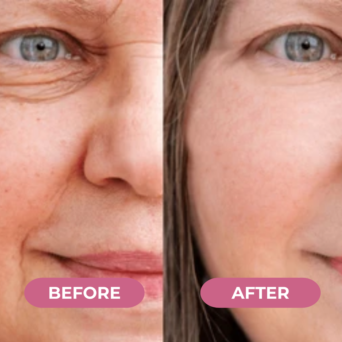 Koriderm™ Mascarilla Nocturna de Colágeno