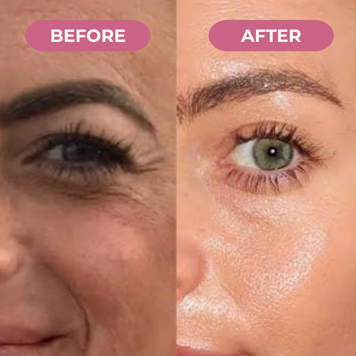 Koriderm™ Mascarilla Nocturna de Colágeno