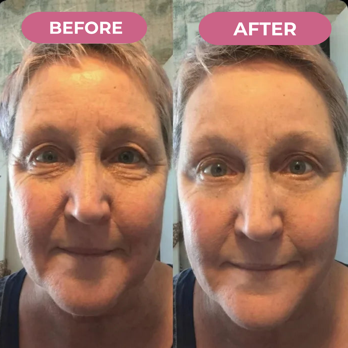 Koriderm™ Mascarilla Nocturna de Colágeno
