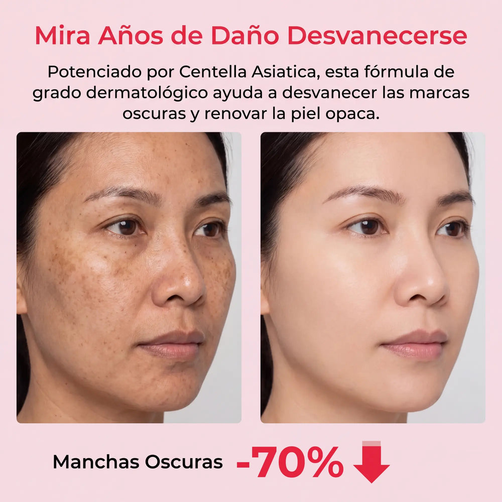 Difumina las manchas y las cicatrices antiguas